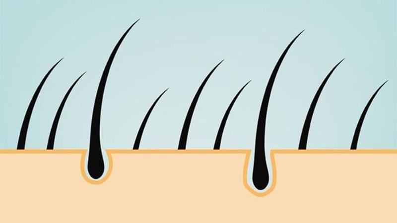 دو روش مفید برای احیا و تقویت فولیکول های مو